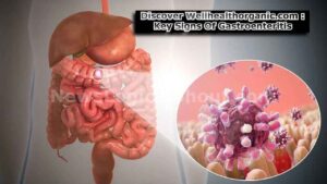 Discover Wellhealthorganic.com Key Signs Of Gastroenteritis